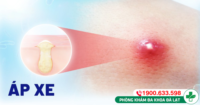 Hình ảnh minh họa